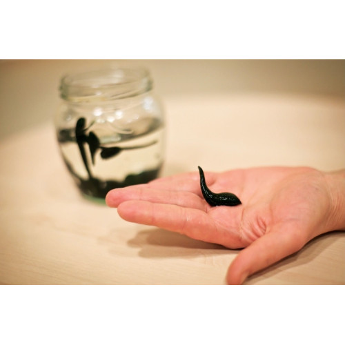 Гирудотерапия